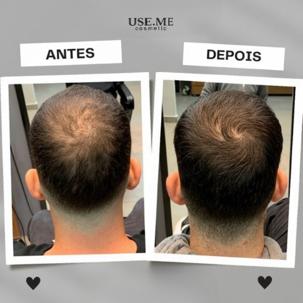 Tônico Crescimento - 3 em 1